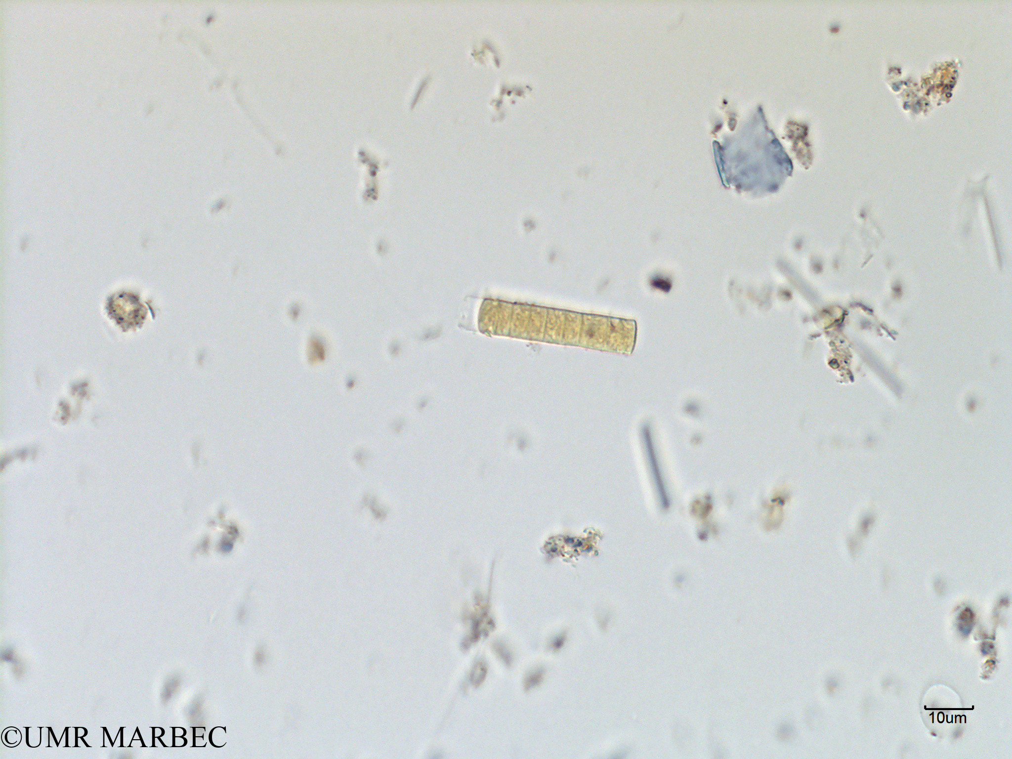 phyto/Scattered_Islands/mayotte_lagoon/SIREME May 2016/Trichodesmium sp4 (MAY4_trichodesmium avec gaine).tif(copy).jpg